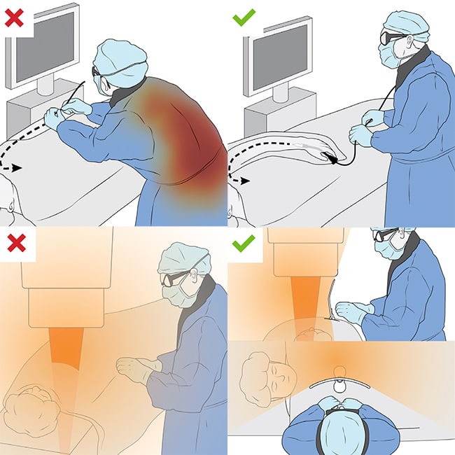 Medical Illustrations for a Medical Device Company